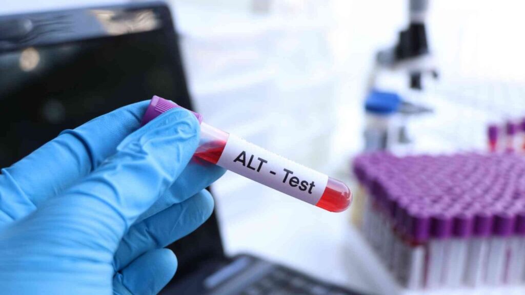 Liver Blood Tests: ALT, AST and Other Results Explained