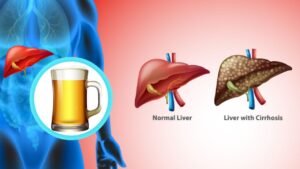 Alcohol and the Liver: Understanding the 14-Unit Guideline